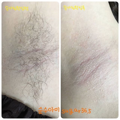 순수아미 이미지