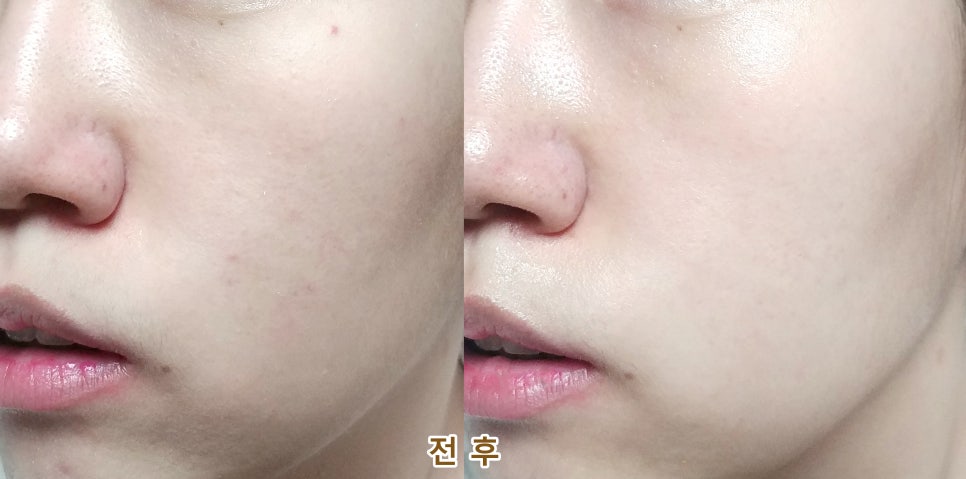 송죽슈퍼 이미지
