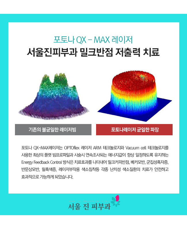 영구반점 이미지