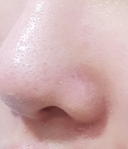 피지메디칼 이미지
