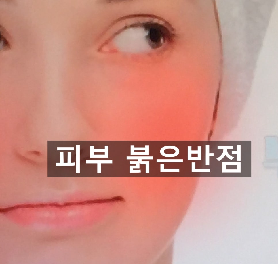 경보반점 이미지