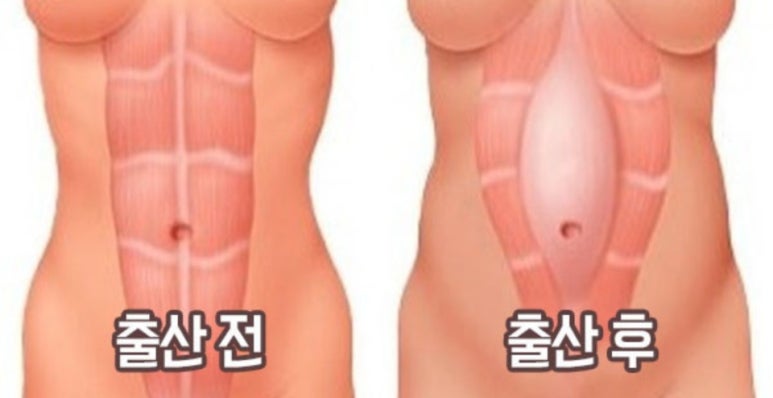 성남출장마사지 이미지
