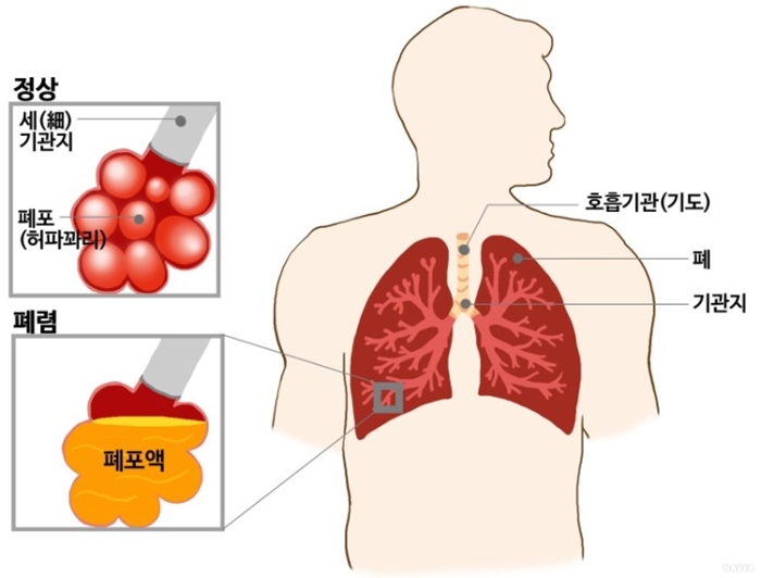 웰키즈소아청소년과의원 이미지