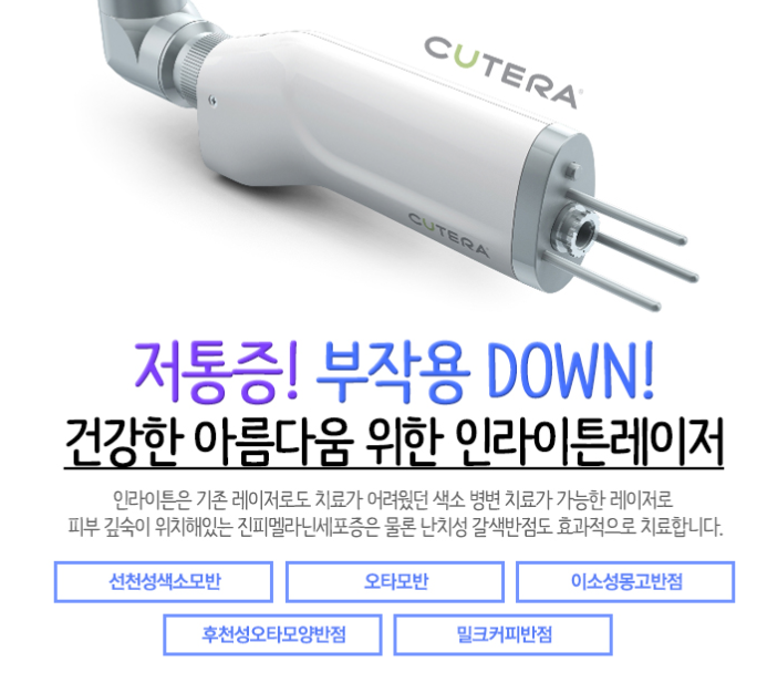 몽고반점 이미지