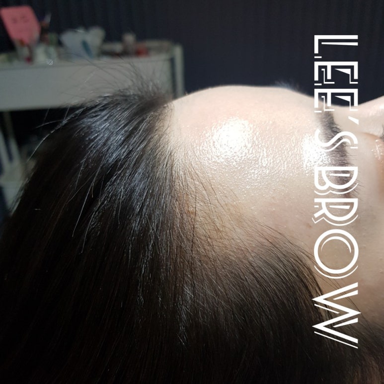 브로우리즈 이미지