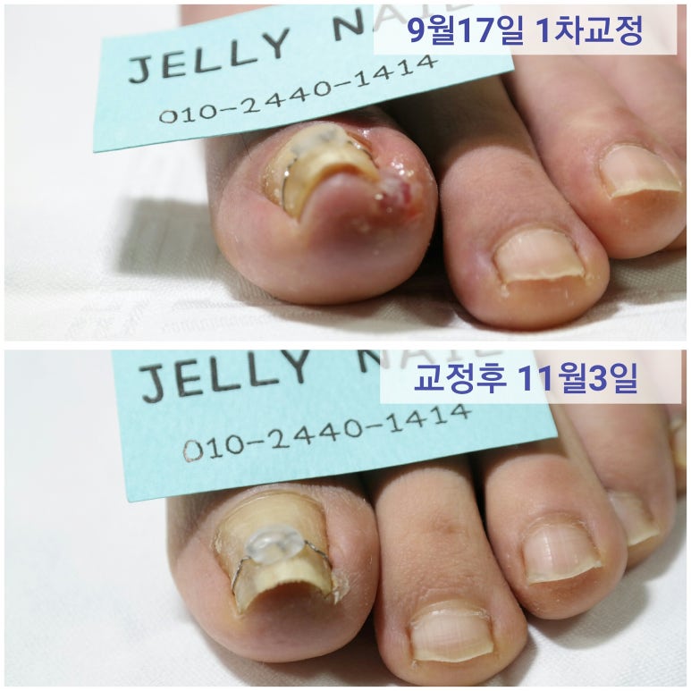 젤리네일 이미지