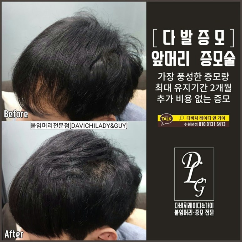 머리하고싶을때 이미지