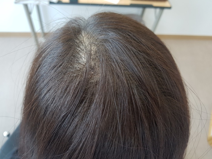 다모헤어 이미지