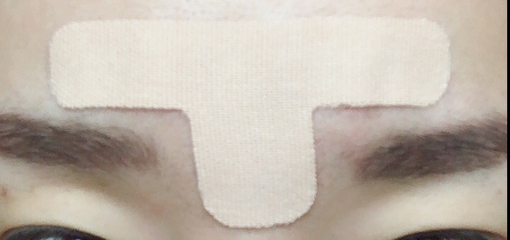 로로피아니 이미지