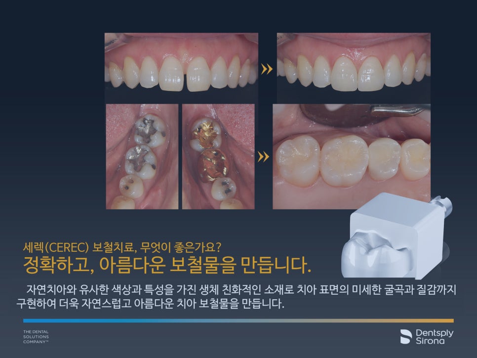 365디지털치과 이미지