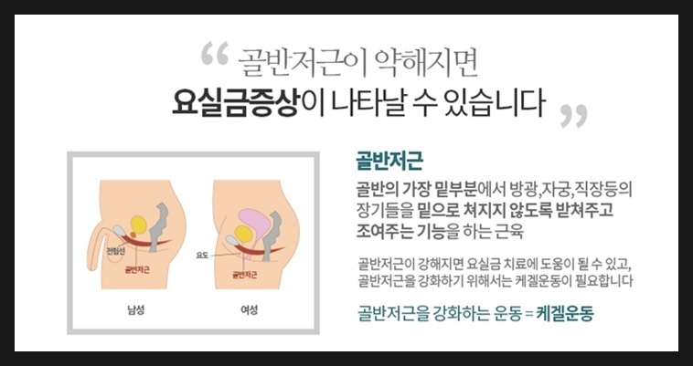 이지케이 이미지