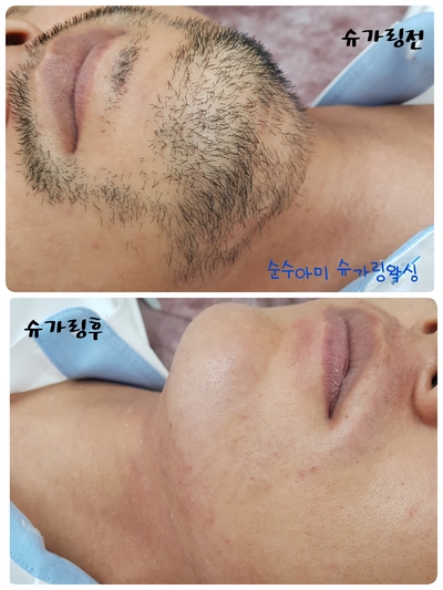 순수아미 이미지