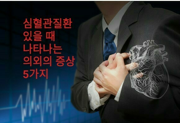 플로렉스 이미지