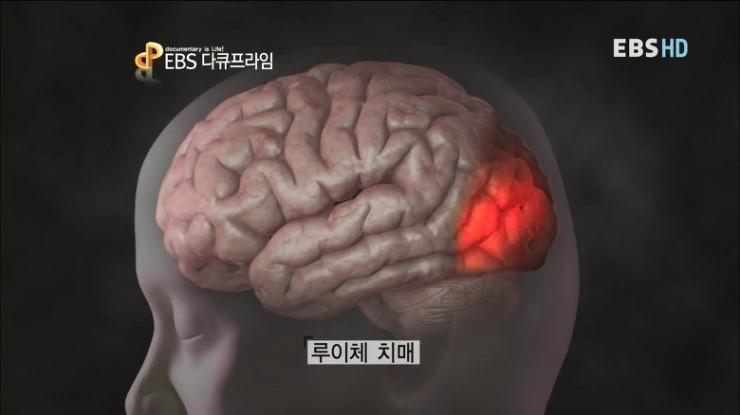 루이체 이미지