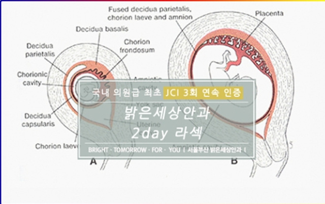 밝은김안과 이미지
