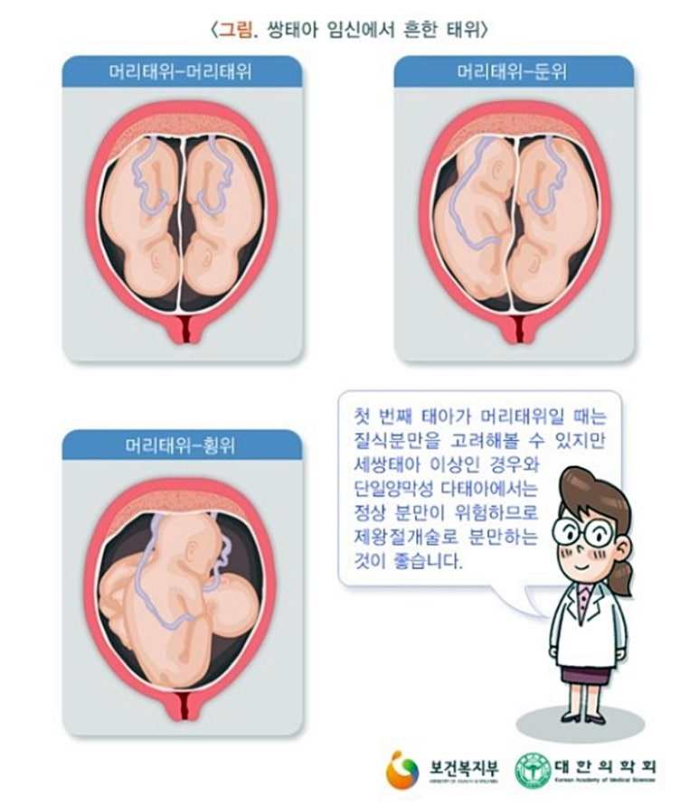 삼성화재해상보험(주) 이미지