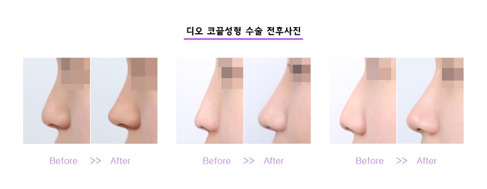 도도성형외과 이미지