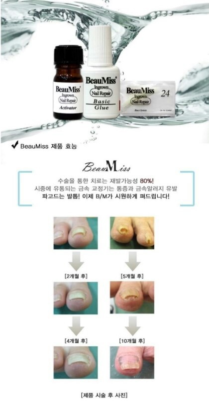 루비네일 이미지