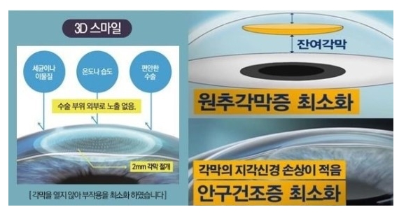 스마일빈 이미지