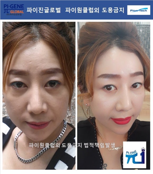 볼륨톡스 이미지