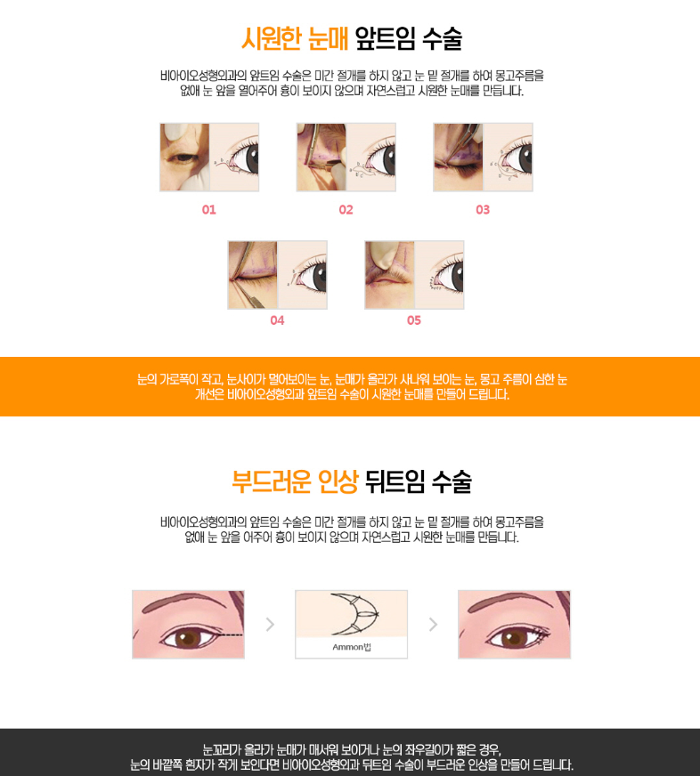 비아이오 이미지