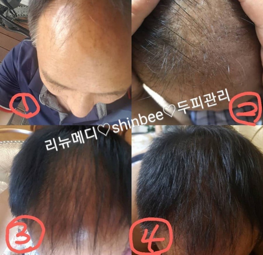 리뉴메디 이미지