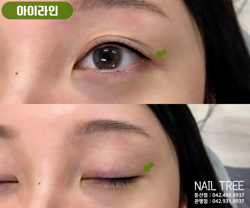 네일트리 이미지