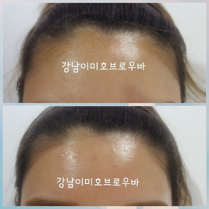 바다헤어라인 이미지