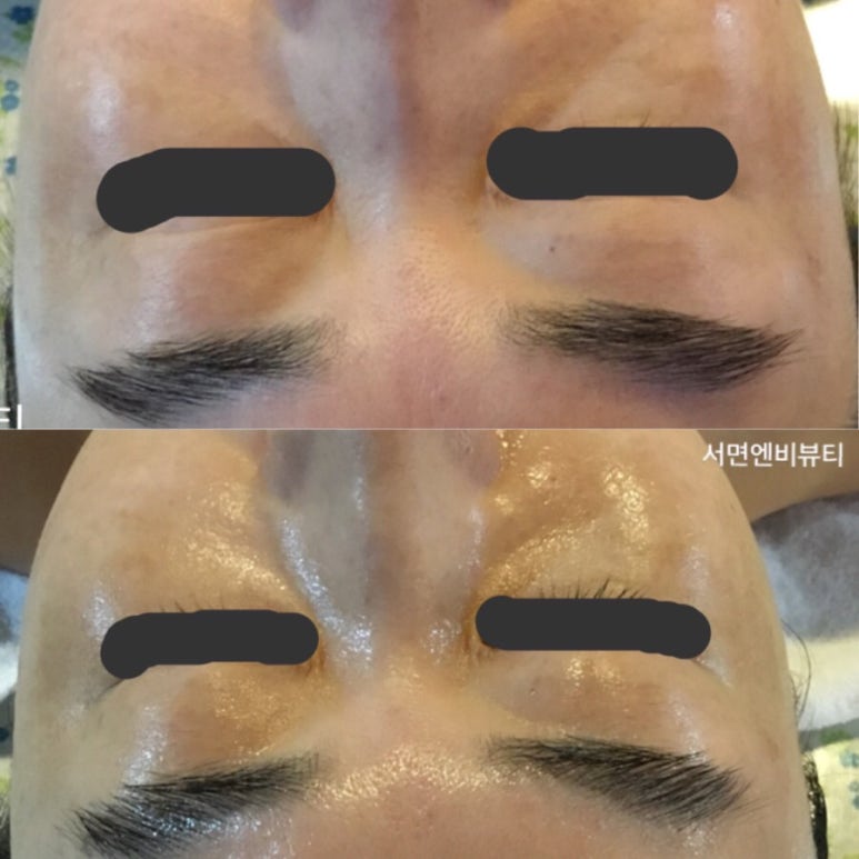 엔비피부관리실 이미지