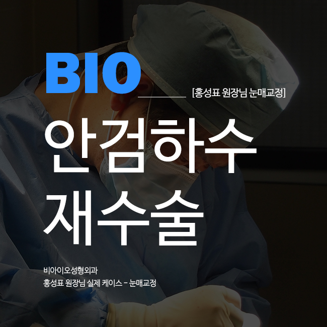 비아이오 이미지