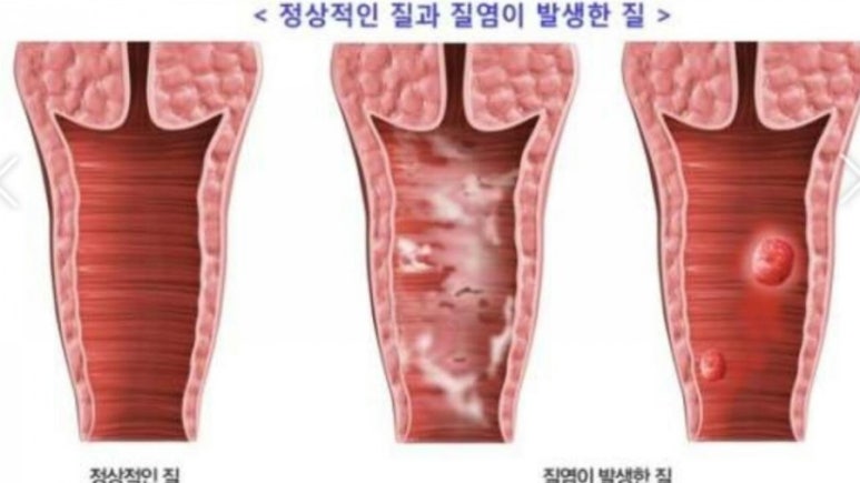 연피부관리 이미지