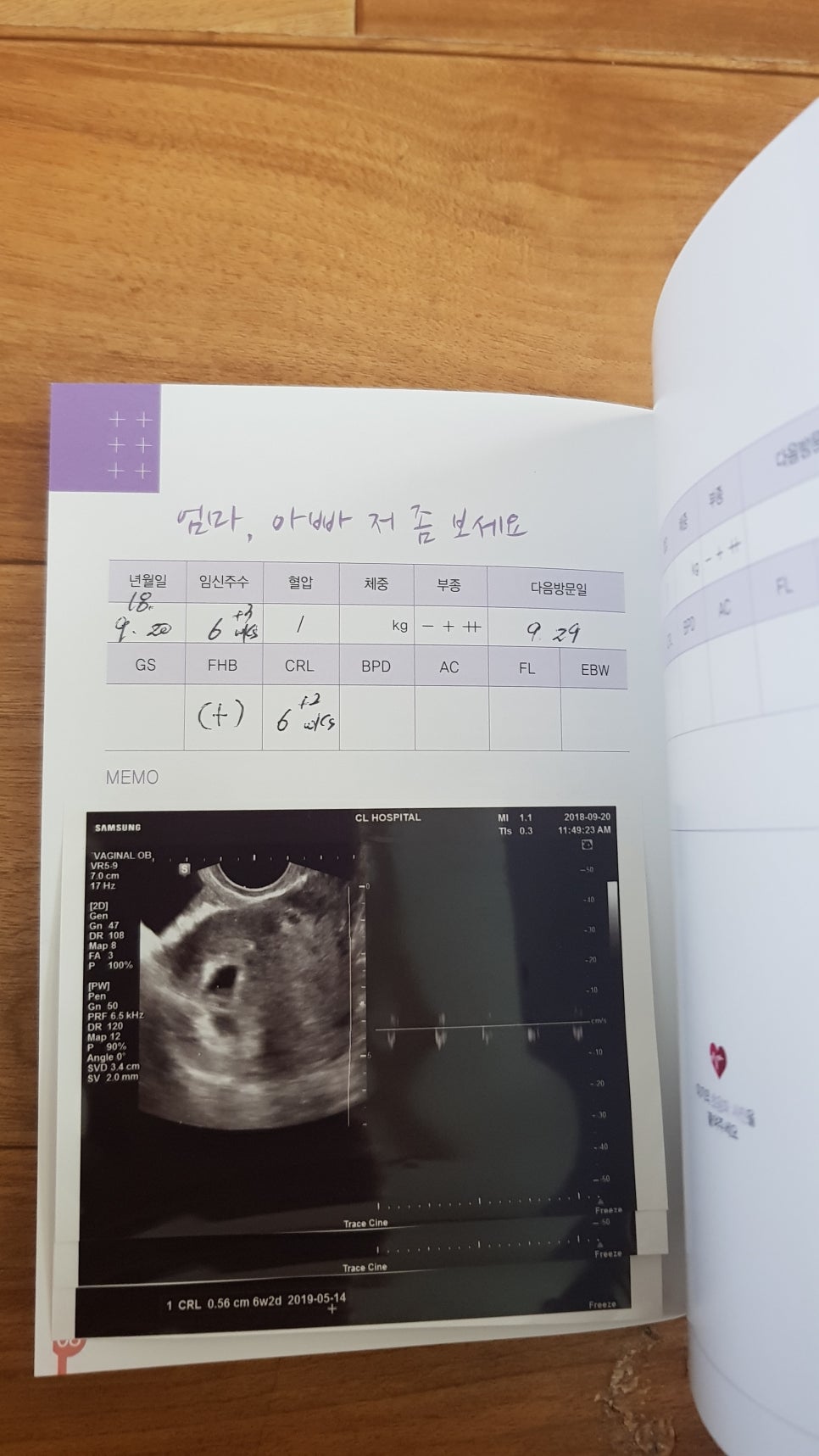 옥이신발 이미지