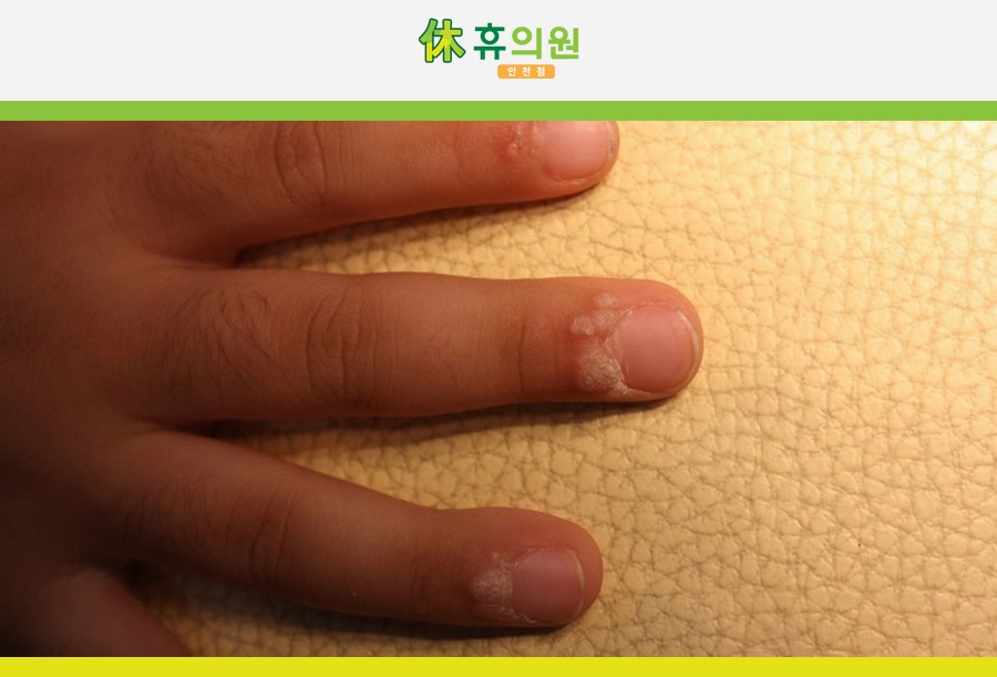 휴의원 이미지