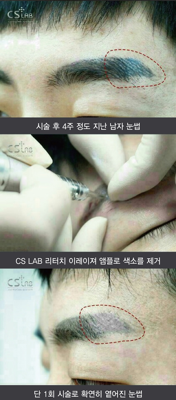 색소랩 이미지