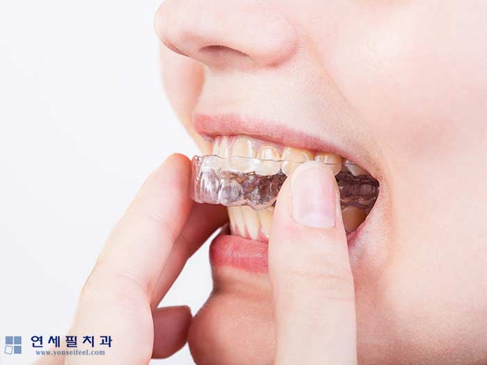 연세필치과교정과 이미지