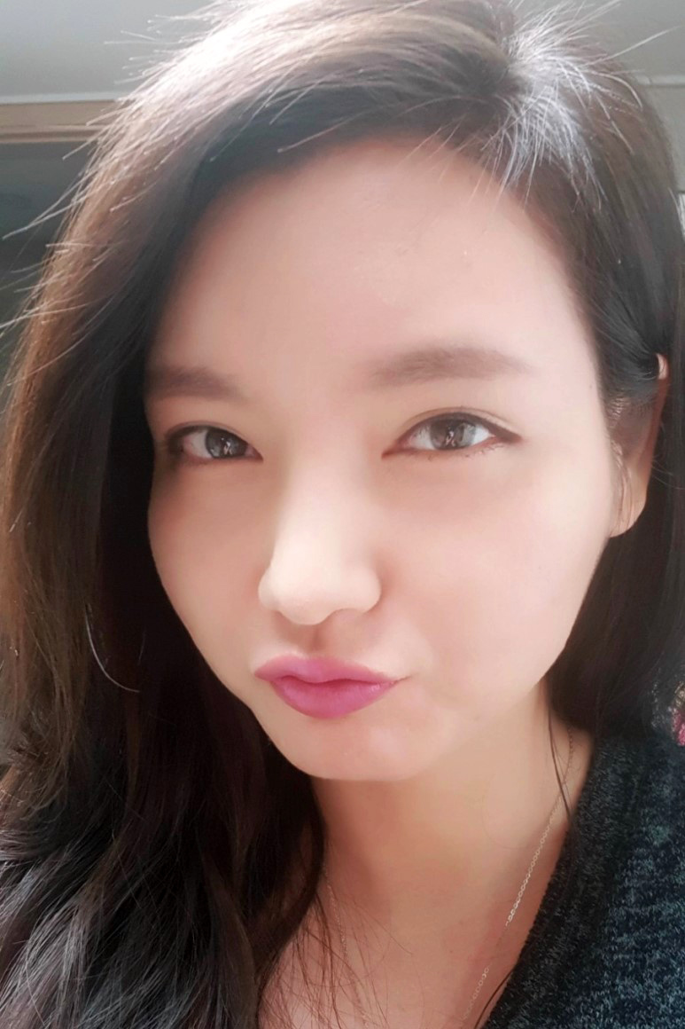 헤어라인 이미지