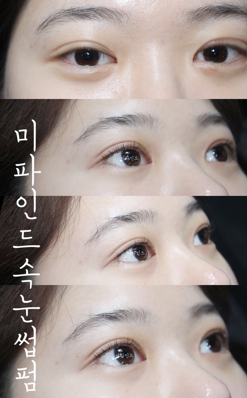미파인드 이미지