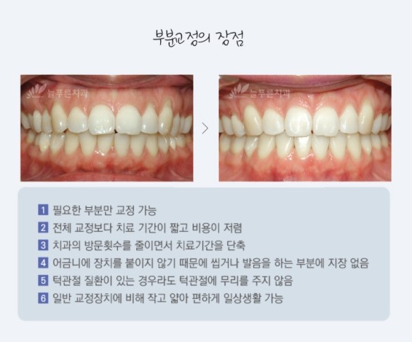 이-푸른치과의원 이미지