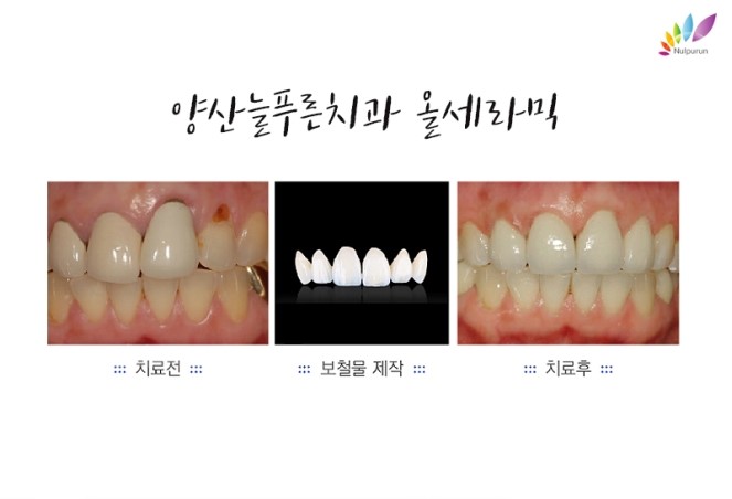 푸른치과의원 이미지