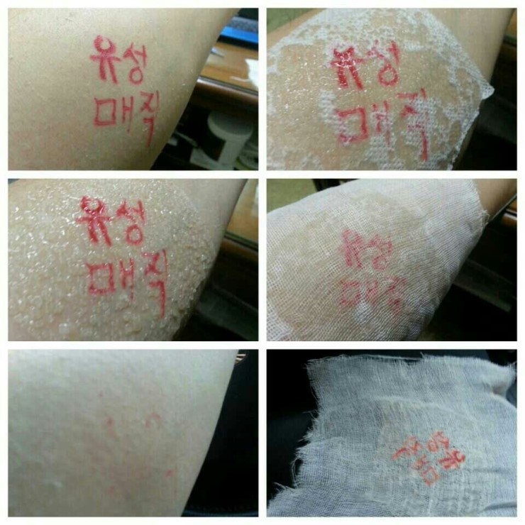 다올테라피 이미지