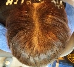 엠지에프두피탈모센터 이미지