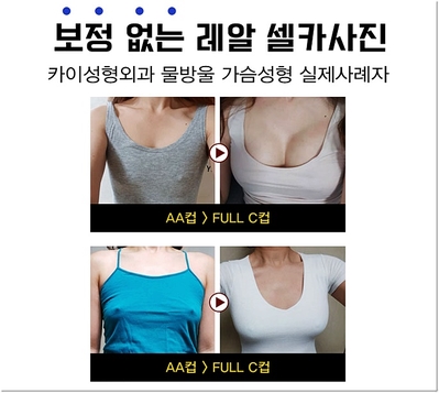 물방울성형외과의원 이미지