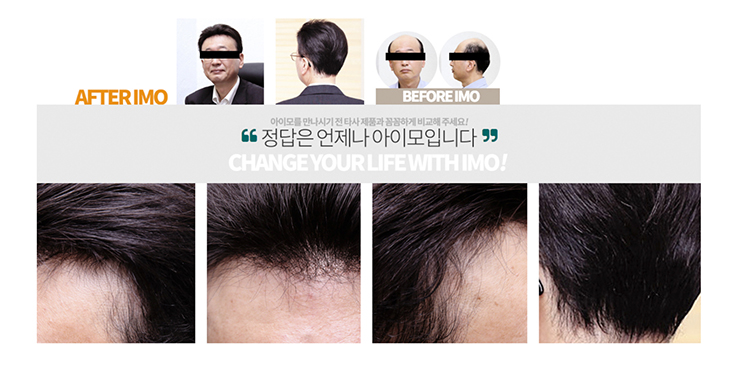 정직한가발아이모 이미지