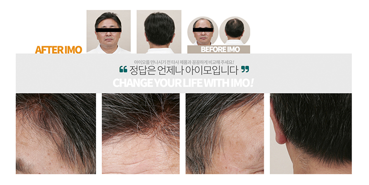 정직한가발아이모 이미지