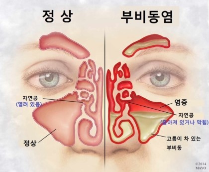 마법의손 이미지