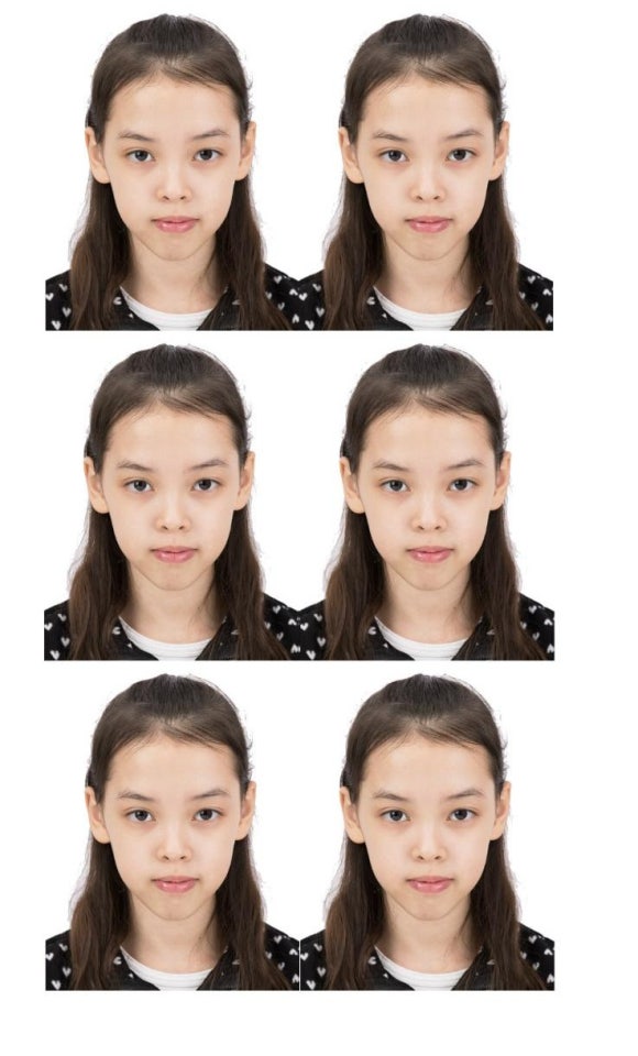베스코아 이미지