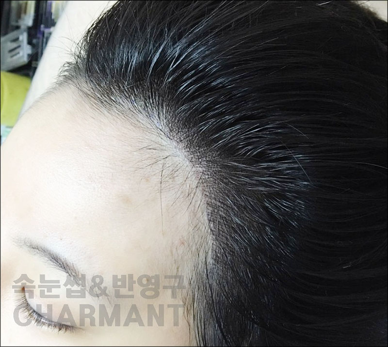 렉스헤어라인 이미지