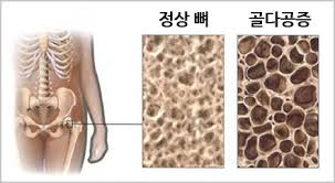 동네헬스장 이미지