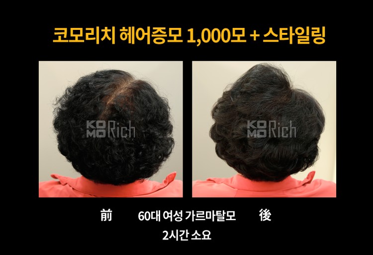 헤어올림픽 이미지