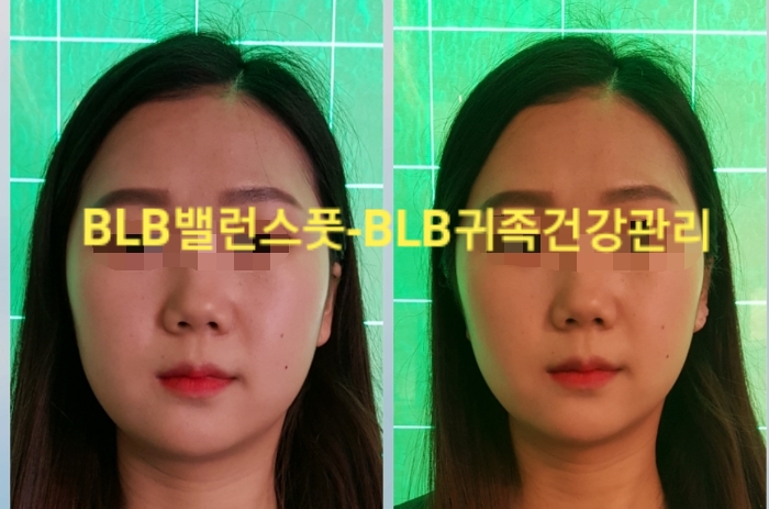귀족체형관리 이미지